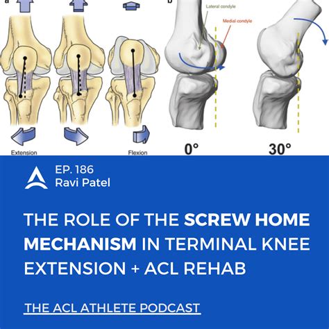 Episode 186 | The Role of the Screw Home Mechanism in Terminal Knee ...