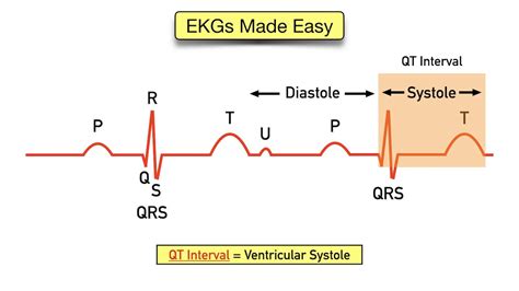 ECG Explained 的图像结果