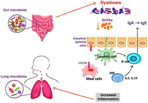 The Role of Gut Bacteriome in Asthma, Chronic Obstructive Pulmonary ...