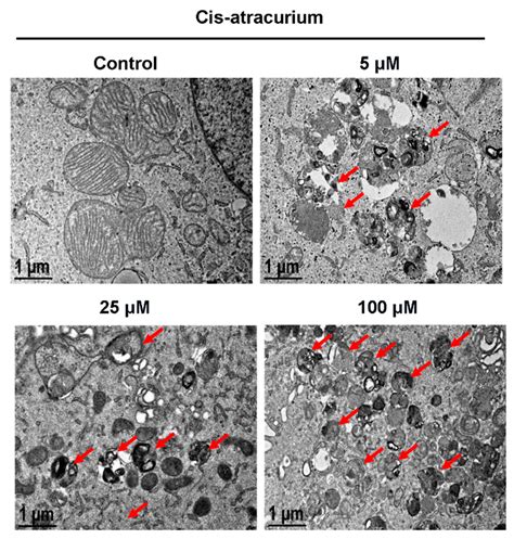 Autophagic Cell Death and Apoptosis Jointly Mediate Cisatracurium ...