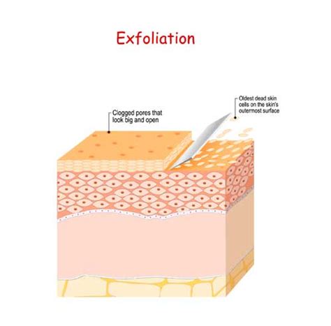 Back Acne: बैक एक्ने बन गए हैं आफत तो जानिए कारण और इलाज | tips to cure ...