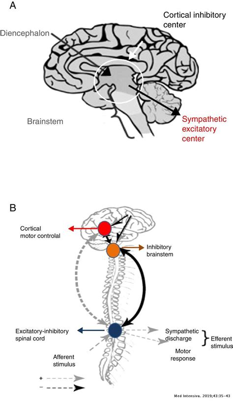Paroxysmal sympathetic hyperactivity: An entity to keep in mind ...