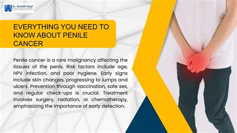 know about penile cancer: Diagnosis, Symptoms | PPTX | Sexual Conditions | Sexual Health
