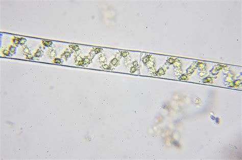 Spirogyra | The Microscopic Life of Shetland Lochs
