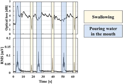 A Fiber-Optic Non-Invasive Swallowing Assessment Device Based on a ...