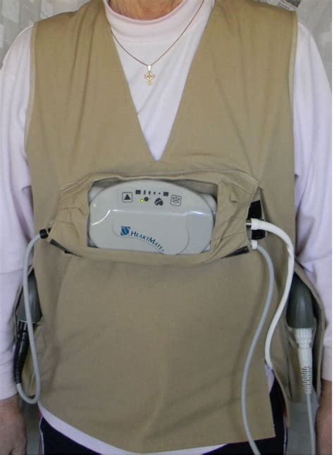 Life Vest Cardiac Weight at Anne Brown blog