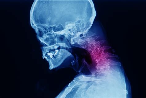 The painful and debilitating condition that is arthritis