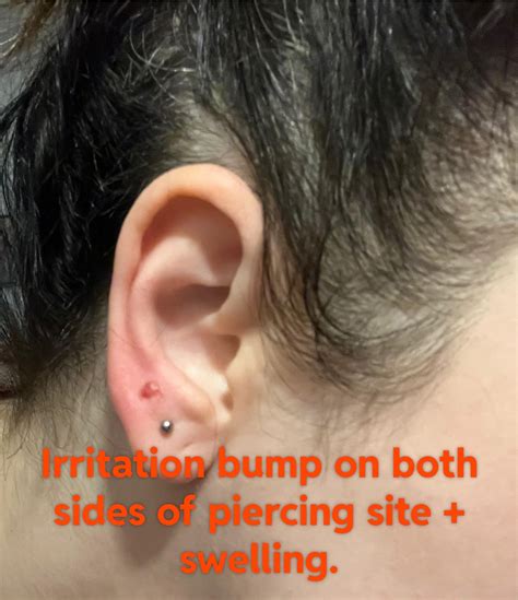 Sad :-( Had to retire 3rd lobe piercings : r/piercing