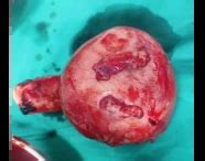 ACTA Medica International — Global Peer-Reviewed Medical Journal