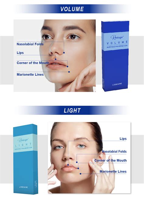 hyaluron pen lip filler price - Dermax Aesthetic