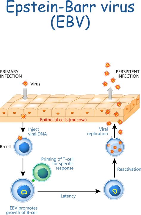 epstein-bar virus (EBV) | PPT - Face Surgery