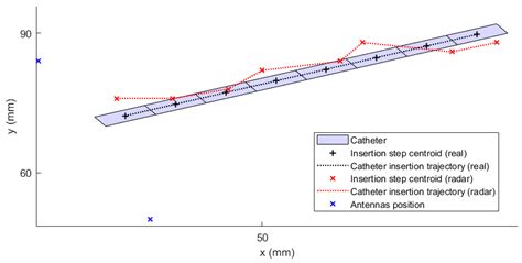 Microwave Catheter Navigation System for the Radiofrequency Liver Ablation