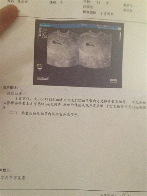 怀孕四十几天b超结果显示孕囊周边及胎芽内见丰富血流信号，医生说可能是双胞胎，又或者是先兆流产，求解 - 百度宝宝知道