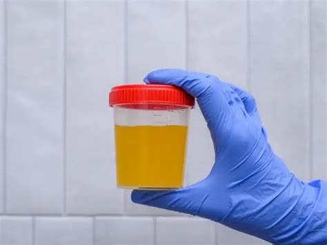 5 prostate cancer signs men shouldn’t ignore today - Know the quiet ...