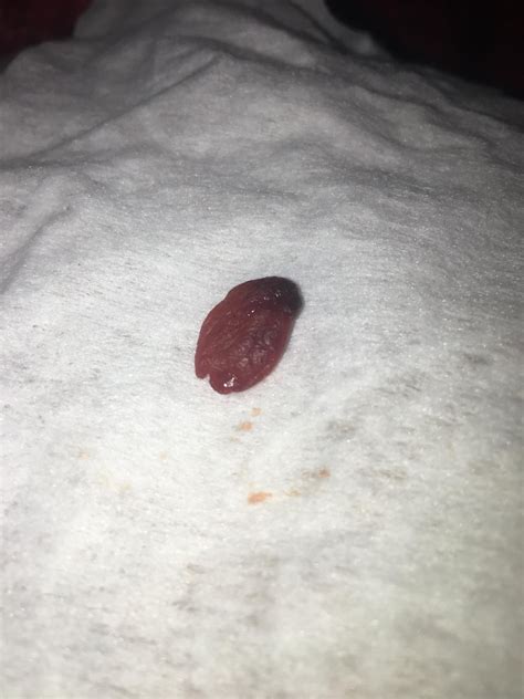 Period patches are my saviour but they aren’t hyped as they should be ...