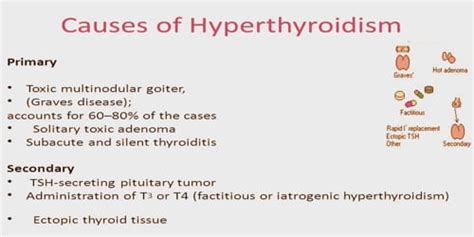 Image result for hyperthyroidism