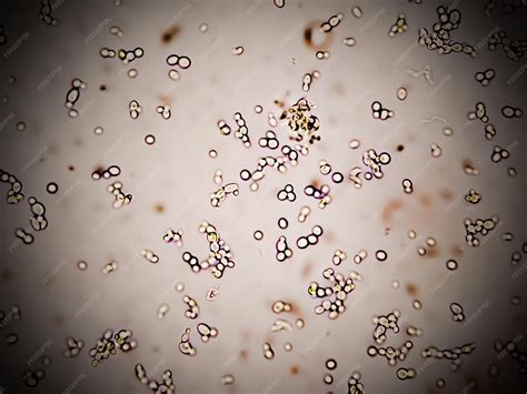 Premium Photo | Budding yeast cells in patient urine urinary tract ...