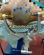 Image result for 立体定向 stereotaxis