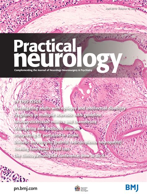 Malingering and factitious disorder | Practical Neurology