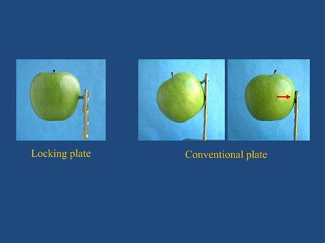 Image result for LCP DB Connection