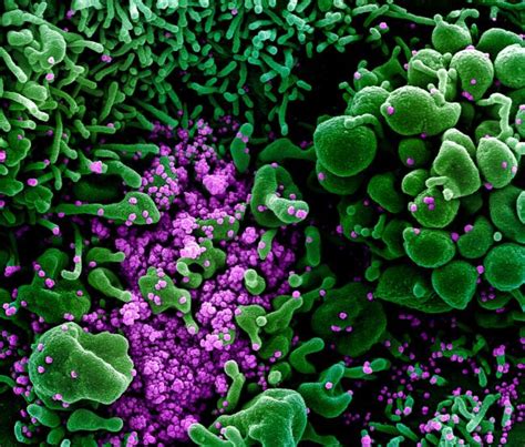 NIH clinical trial of hydroxychloroquine, a potential therapy for COVID ...