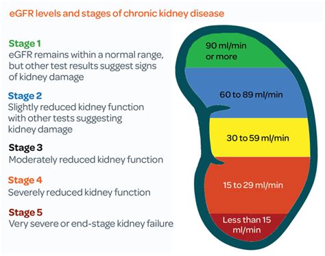 Chronic Kidney Disease | Swan Medical Group