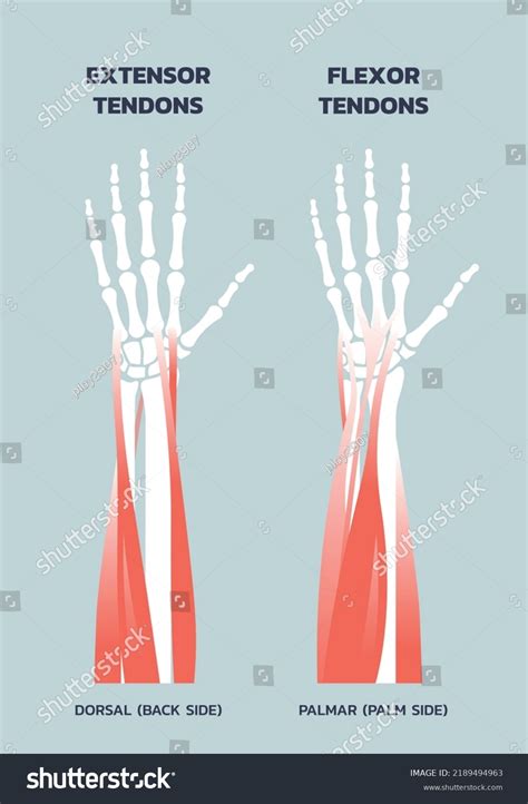 Tendons Hand Wrist Flexor Extensor Tendon Stock Vector (Royalty Free ...
