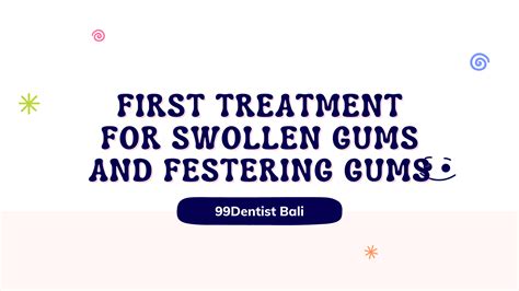 First Treatment for Swollen Gums and Festering Gums - 99DentistBali