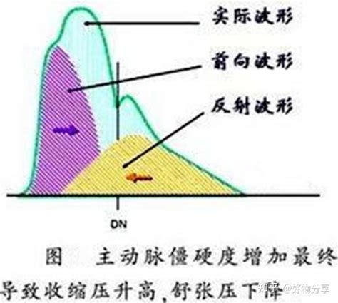 低压 的图像结果