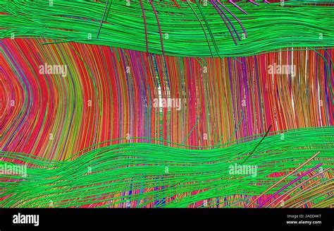Image result for Diffuse Tensor Imaging