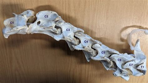 cervical vertebrae — European Trainer Article Index | Trainer Magazine