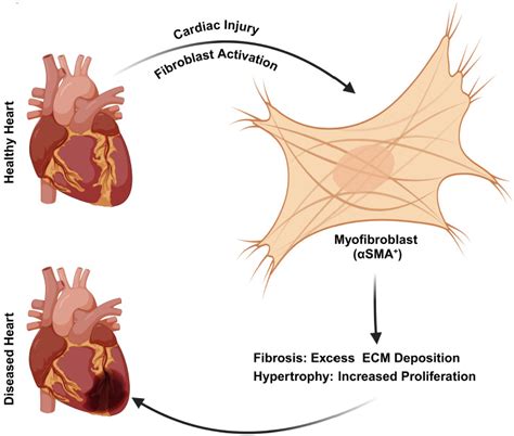 Cardiac Fibroblasts: Helping or Hurting