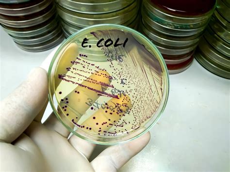 De Salmonella à Listeria en passant par E.Coli, hypothèses sur le terrain dans les toxications ...