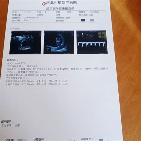 分娩预演丨了不起的妈妈，真实再现分娩全过程-武汉百佳妇产医院