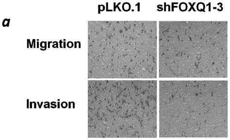 IJMS | Special Issue : Genes and Pathways in the Pathogenesis of ...