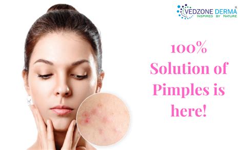 Best Acne Products Of All Times – VedzoneDerma