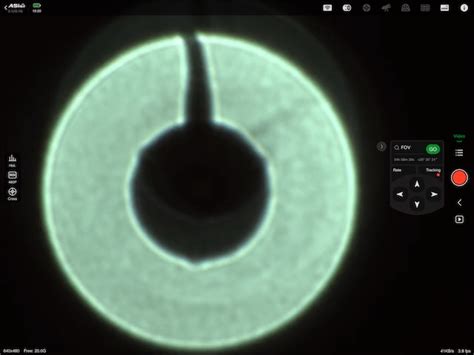 Hyperstar Collimation 的图像结果