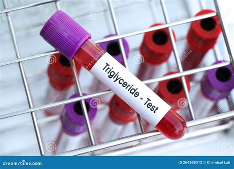Triglyceride Test To Look for Abnormalities from Blood Stock Photo - Image of complete ...
