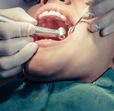 Invisalign treatment in Madipakkam | Best orthodontist in nanganalur