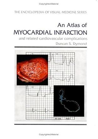 Buy An Atlas of Myocardial Infarction and Related Cardiovascular ...