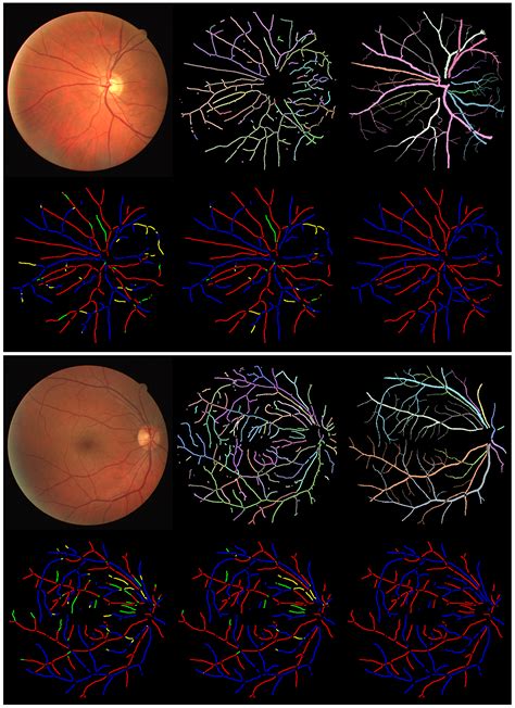 Topology-Aware Retinal Artery–Vein Classification via Deep Vascular ...