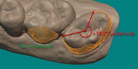 MeshLab Fill Hole 的图像结果