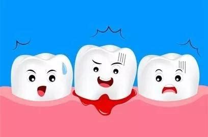 牙龈出血为什么这么常见！真的是因为缺少维C？
