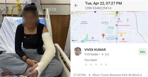 Ola Faces Backlash After Noida Woman Suffers Fracture During Bike Ride ...