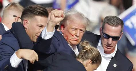 ear lace: News, Articles and Blogposts about ear lace – Times of India