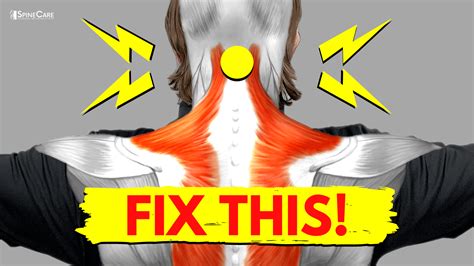 How to Fix a Snapping and Popping Neck | SpineCare | St. Joseph, MI
