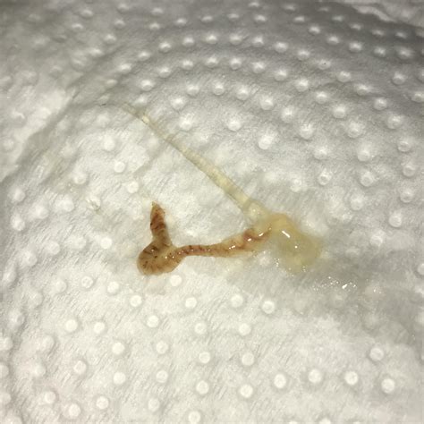 Why does my booger have a spiral like that? : r/boogers