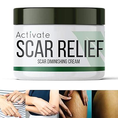 Activate Scar Removal Cream - Natural Healing India | Ubuy