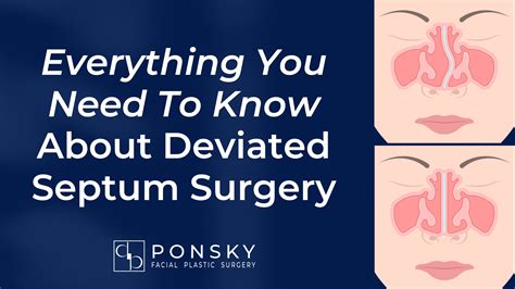 Deviated Septum Surgery: Everything You Need To Know