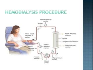 Image result for Dialysis Procedure Step by Step